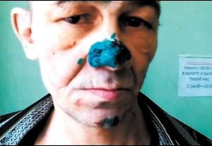 Гость отправил в больницу сироту