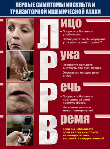 Что нужно знать об инсульте