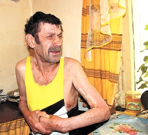 Пациента выписали из больницы с инсультом
